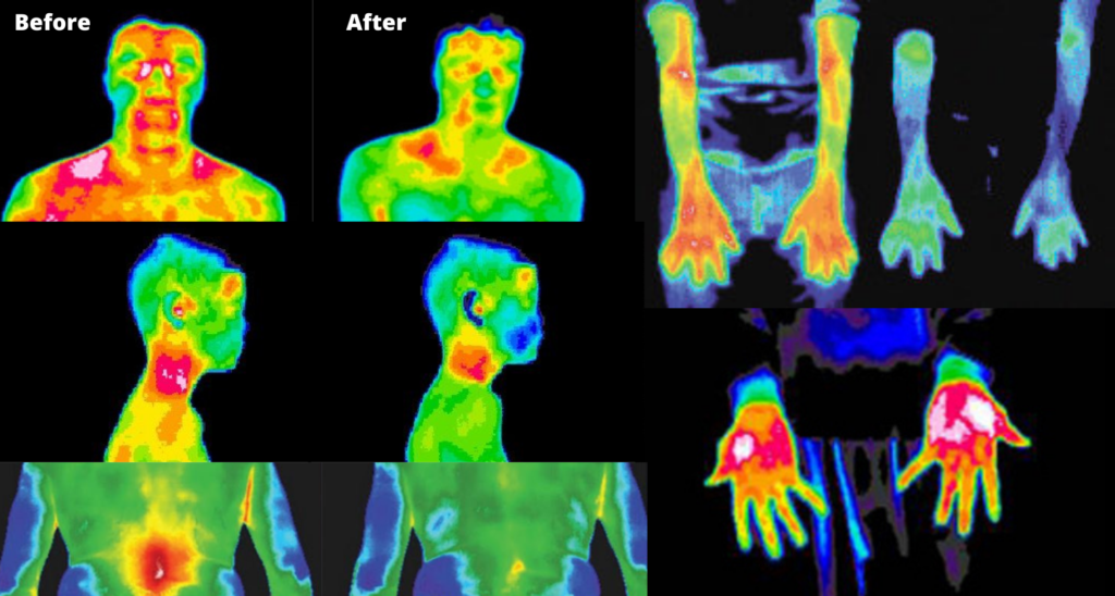 before and after inflammation reduction